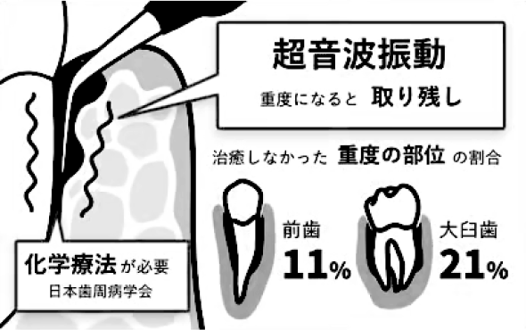 従来の治療法